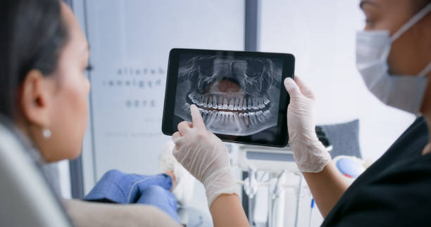 Licensed Tooth Extraction service in Lexington, IL - Smile Center Dentistry